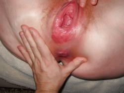ditafist:  After fist  Completely ruined pussy - lovely