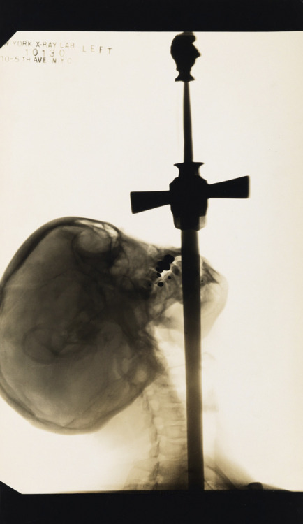 noinu-xodor:  noinu-origin:  blueblackdream:Edward J. Kelty, X-ray of Ajax, “The Sword Swallower”, 1928  Edward J. Kelty, X-ray of Ajax, “The Sword Swallower”, 1928    Kelty 1928