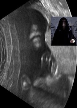 dorkly:  Emperor Palpatine Ultrasound Release your anger! Also me, not sure how I got stuck in here.