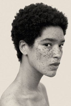 s0mmerspr0ssen:   For his recently published picture book Freckles (Splice Pictures Publishing), the Swiss photographer Reto Caduff has taken pictures of freckled women all over Europe. His pictures prove: freckles are beautiful. Don’t hide yourself