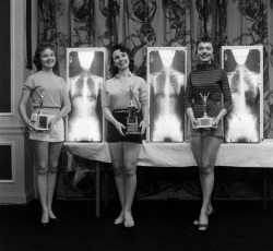 barbie-isalive:  sixpenceee:  MIss Correct Posture (1956). In the 50’s and 60s’, American chiropractors held a series of rather unusual beauty pageants where contestants were judged and winners picked not only by their apparent beauty and poise,