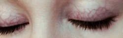 flowerette:  my sister has eyelids like this and she always looks like she’s wearing lavender eyeshadow it’s pretty 