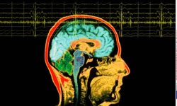 neuromorphogenesis:  Your brain sees things