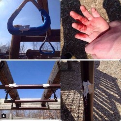 bdgfthings:  webabuser:  milsotherapy:  marinewifeandmama:  Can I get everyone to REBLOG this please? I can’t imagine this ever happening to kids, especially at a place MEANT for them! Teens or a group of teens are doing this in playgrounds, please