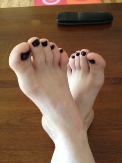 Love the black painted toenails