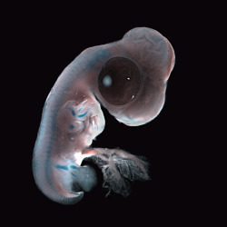house-of-gnar:  Fluorescent Embryos  [Image 1] Chick ectopic limb. An FGF-4-soaked bead was implanted at stage 14. The embryo was fixed four days later, and stained with alcian blue to reveal the developing cartilage of the skeleton. An ectopic limb