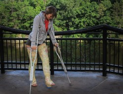 Girl in double long leg walking cast and crutches outdoorsDLLC / DLLWC