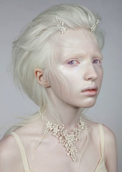 Lieutenantcommanderbadwolf:  Quirkyprotagonist:  Nastya Zhidkova - Albino Model She
