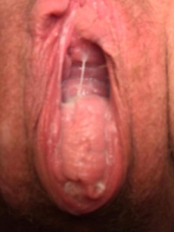 firefly816:My wife’s bucket after a good fisting and prolapse push. Please plug her cunt all the time and get her to push out really hard and birth big objects. Want to see her looser and prolapsing more!