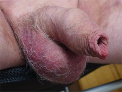 my tiny cock, showing foreskin