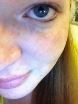 hidetheshadows:  Aw! It looks like I have a love heart in my pupil aha!