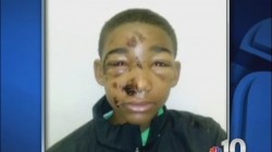 liberalsarecool:   Pennsylvania cops Taser handcuffed 14-year-old in the face ‘for his safety’ A mother in Pennsylvania is threatening to sue after officers shocked her 14-year-old son in the face with a Taser while he was handcuffed. Mother Marissa