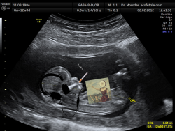mydogsnokes:  picture of me in the womb  same actaully 