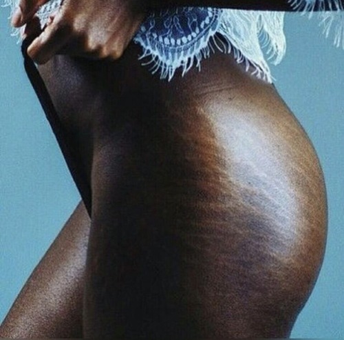 Porn mahoganypeople:  Ode to the stretch marks photos