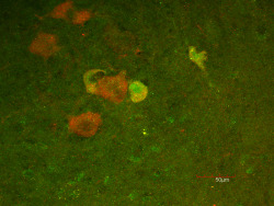 neurosciencestuff:  (Image caption: The presence of p45 (green staining) and p75 (red staining) indicates that motor neurons increase both p45 and p75 expression after sciatic nerve injury in an animal. Image credit: Courtesy of the Salk Institute for