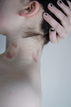 nawayoi: stolze:  Theme of the Day: Sex Bruises - Hope to get some in a view days… :-)   (via bloginterrupted-deactivated2010)  (via nawayoi)L
