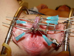 At the risk of a repeat, I think this is a clearer view on one I reblogged previously. BDSM, flaps sewn to restraints to expose pussy, clit and clithood clamped and pierced with needles. Lovely!