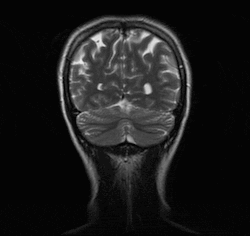 mypsychology:  annadraconida: My fave MRI so far. 