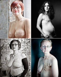 crowcrow:  the scar project: surviving cancera series of large-scale portraits of young breast cancer survivors,shot by fashion photographer david jay.breast cancer is the leading cause of cancer deaths in young women ages 15-40.  thescarproject.org