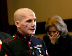  The beautiful face of courage: Lance Cpl. William Kyle Carpenter USMC Carpenter, 21, of Gilbert lost the eye, most of his teeth and use of his right arm from a grenade blast Nov. 21 near Marjah, Helmand Province, Afghanistan.Friends and family say he