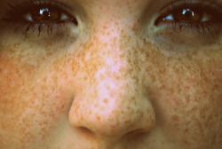 bohemian-feathers:  frecklessss 