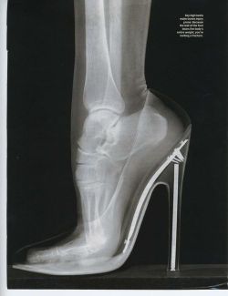 irrelephant11:  tentacletherapissed:  stardustkr7:  misocorny:  That’s why it fucking hurts  Someone please show this to those fucking dudebros who want women to wear heels all the time instead of flats/flip flops….  major props to the people who