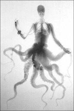 mirrormaskcamera:  La collana di perle, 2002.  Benedetta Bonichi. Hybrid Creatures in X-Ray via Coilhouse 