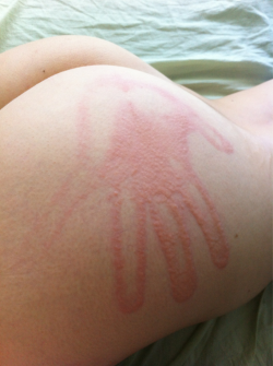 pretty-procrastination:  awh, my butt got famous. oui, it’s a real hand mark. 