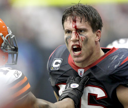 siphotos:  Texans linebacker Brian Cushing is fired up after being hit by Browns guard Shawn Lauvao in the second quarter of Sunday’s game. Lauvao was called for a personal foul as Houston rolled by Cleveland, 30-12. (AP/David J. Phillip) KING MMQB: