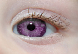 lmprovident:  theprettychoice-deactivated2015: “Alexandria’s Genesis, a.k.a violet eyes (a genetic mutation). When someone is born with Alexandria’s Genesis, their eyes are blue or gray at birth. After six months, the eyes begin to change from their