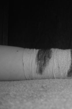 courtsoflife:  E eu pensei que iria aguentar a vontade de ver o meu sangue escorrendo pelo meu braço, só que a vontade foi maior que eu. 