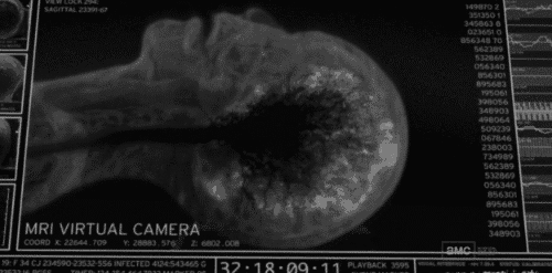 invading-your-private-thoughts:  This is someone dying while having an MRI scan. Before you die, your brain releases tons and tons of endorphins that make you feel a range of emotions. Tragically beautiful 