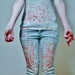 shot-at-redemption:  Self Harm is not always obvious. 