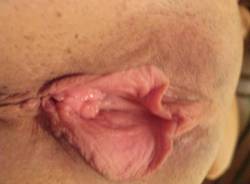Sorry for such a close up shot. I I use to look at my dads playboy magazines and I use to think it was not normal to have big labia minora. I found out they would airbrush the big labias sometime or make them symmetrical . Please let every women out there