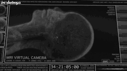 xwhatserface:  This is a person dying under an MRI scan some doctors don’t know what the fuck they’re doing and shoot their patients tragically beautiful.  *blinkblink* This is from The Walking Dead. 