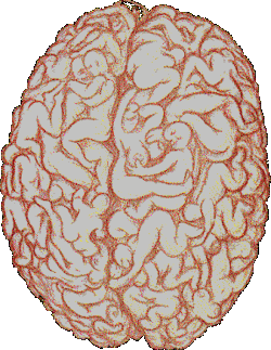 pic of my last brain scan