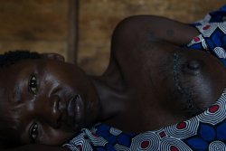 Warwithinaframe:  Nzigire, 25, Rests In A Bed In Gersom Hospital In Goma (October