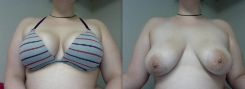 masturbatingprincesses:  _______________Hot submission, lovely tits! Topless tuesday is off to a good start!