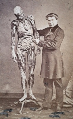 sutured-infection:  Daguerreotype of Dr. Louis T.J. Auzoux and paper-mache model, c. 1860 