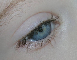 This Eye Remember My Mom.. Just Before She Passed Away, Her Eyes Were Just Like This