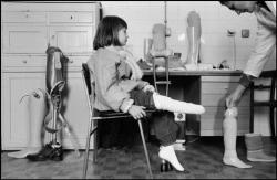 Fotojournalismus:  Sarajevo, 1993. Nine Year Old Samra Grapho Had A Foot Amputated