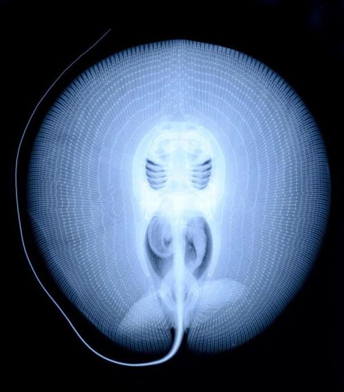 jtotheizzoe:  An X-ray of a stingray, whose cartilage skeleton (similar to that of sharks) looks like one of those embryonic alien incubators from the opening scene of a horrific sci-fi movie. (via Twisted Sifter)