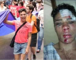 miss-princess-bitch:  This man was brutally beaten because of being proud of being gay. Personally, I really think that gay should be a normal thing to talk about, like when i have a child i want him to come home and say ‘i really like this boy, hes