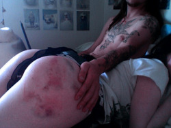 ass bruises are my fav.